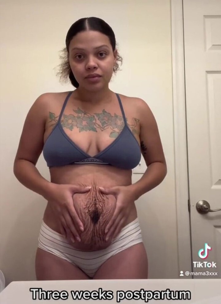  Bà mẹ trẻ hút 19 triệu lượt xem sau khi đăng tải hình ảnh cơ thể sau khi sinh nở